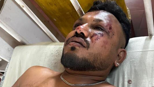 A miracle in seat 11A: What we know about the sole survivor of Air India crash Vishwash Kumar Ramesh